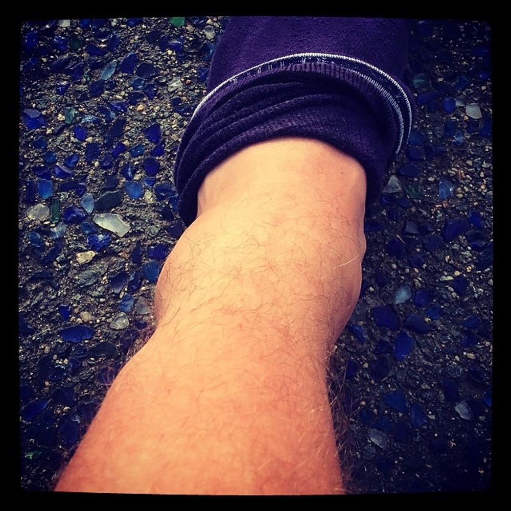 My bum ankle can't handle it #
