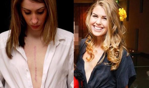 Belle Gibson