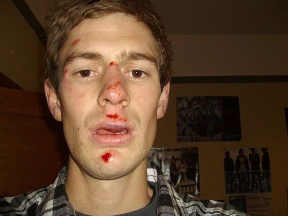 I GOT KNOCKED THE FUCK OUT